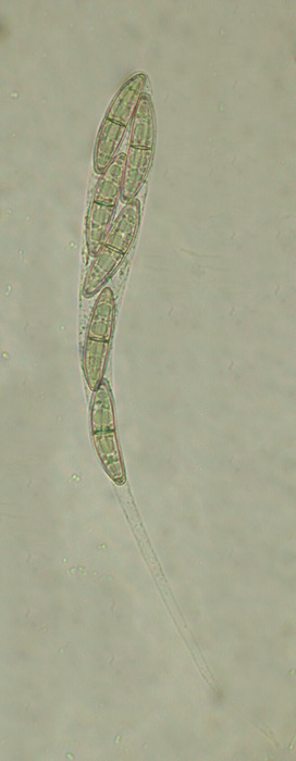 macrostoma