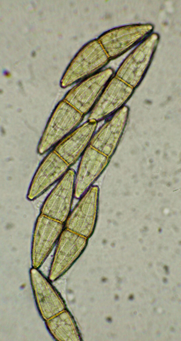 macrostoma