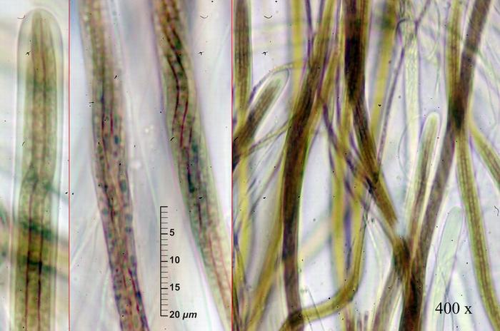 macrostoma