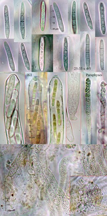 macrostoma
