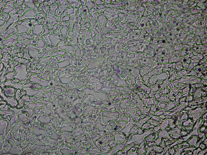 macrostoma