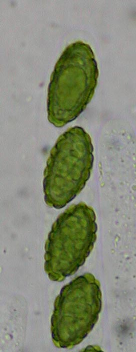 macrostoma