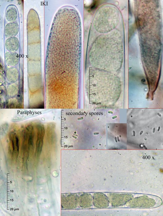 macrostoma