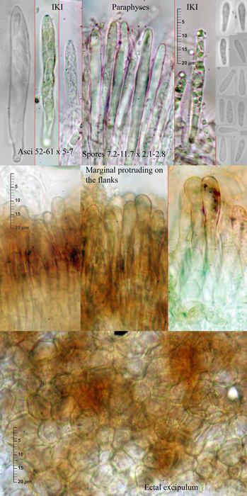 macrostoma