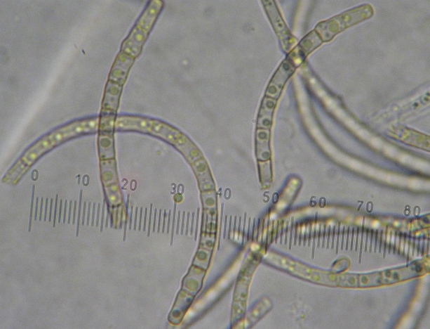 macrostoma