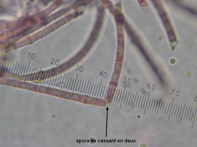macrostoma