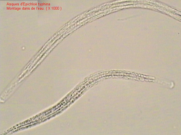 macrostoma