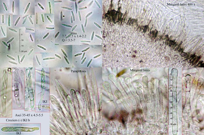 macrostoma