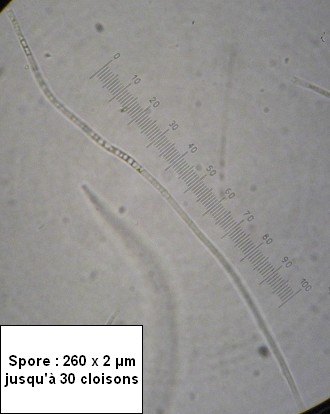 macrostoma