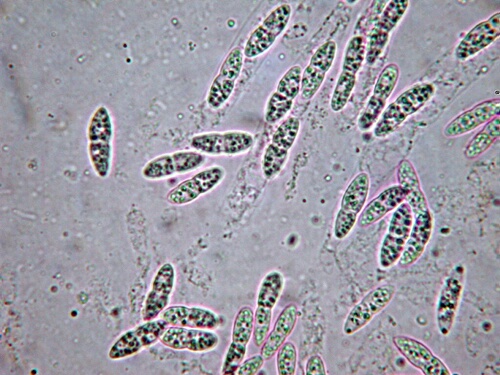 macrostoma