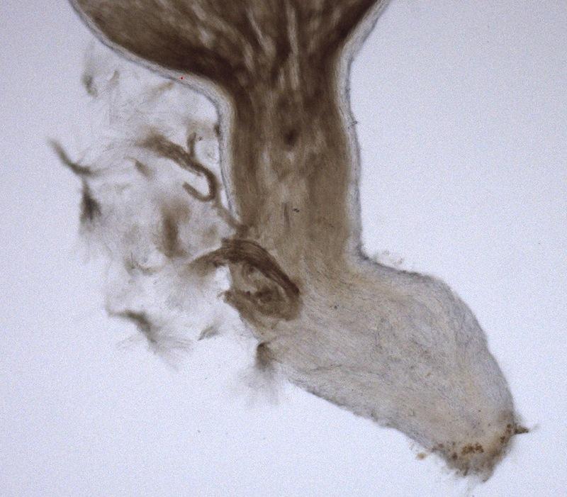 macrostoma