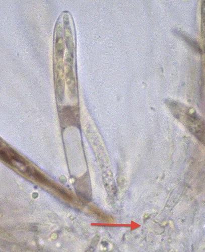 macrostoma