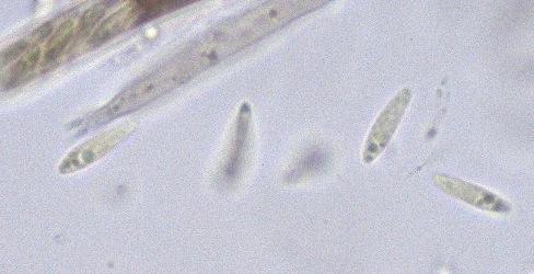 macrostoma