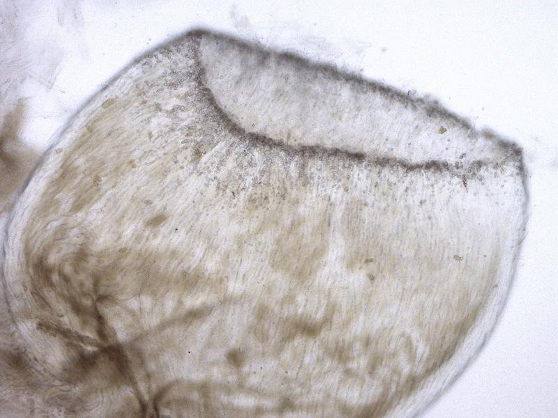 macrostoma