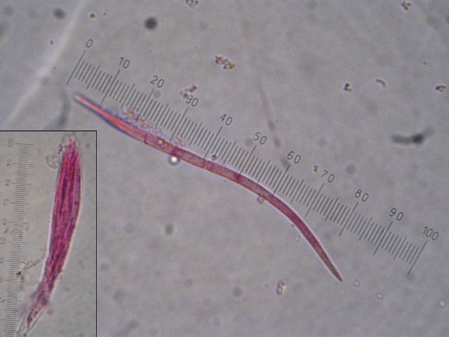 macrostoma