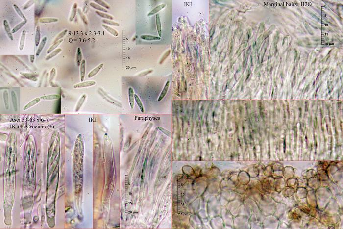 macrostoma