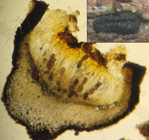 macrostoma