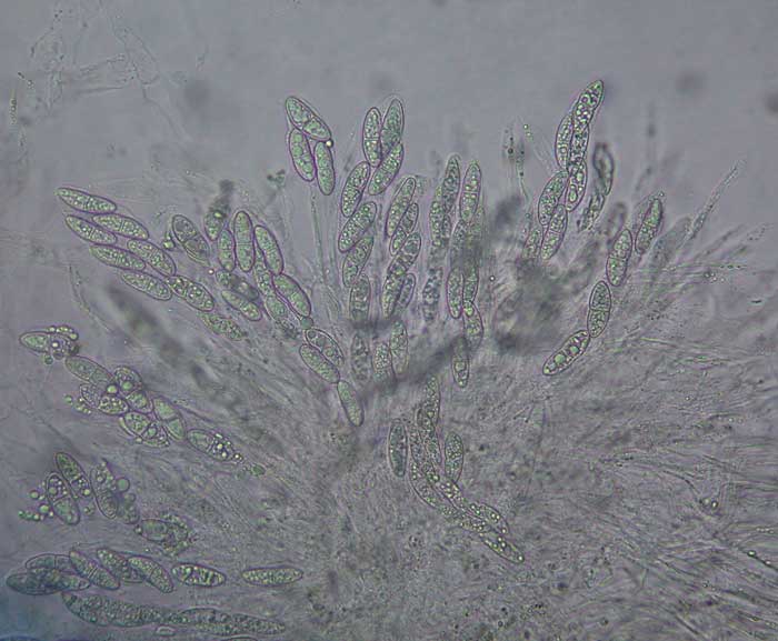 macrostoma