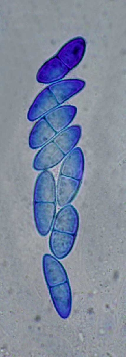 macrostoma