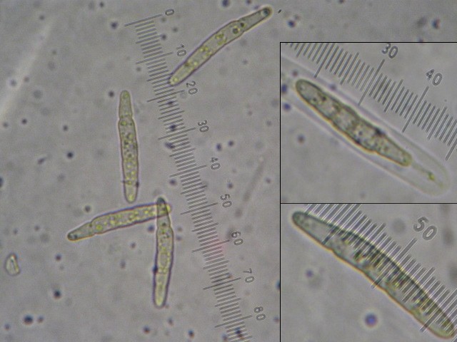macrostoma