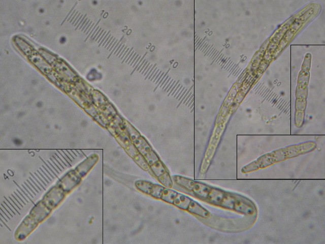 macrostoma