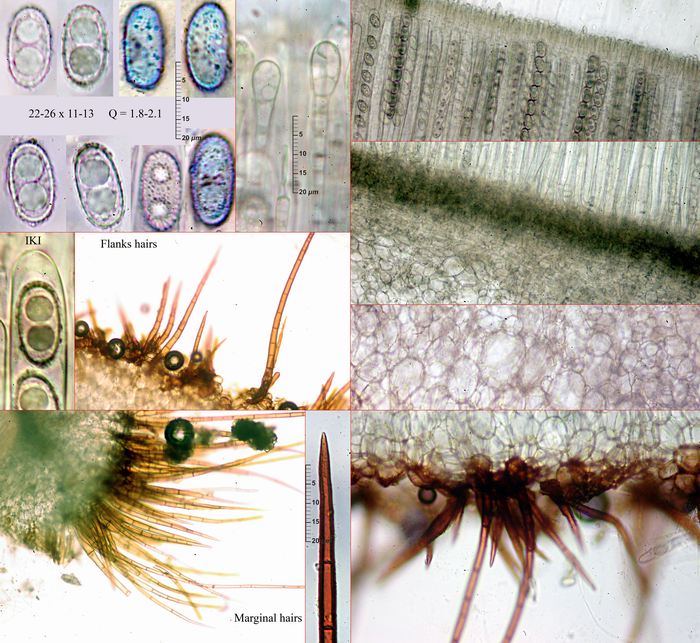 macrostoma