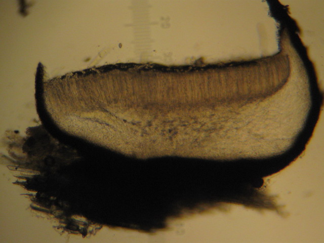 macrostoma