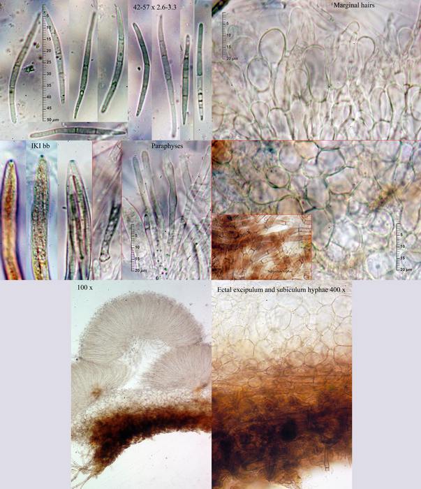 macrostoma