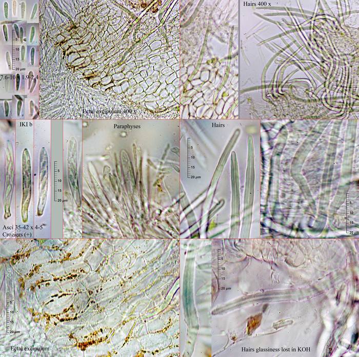 macrostoma