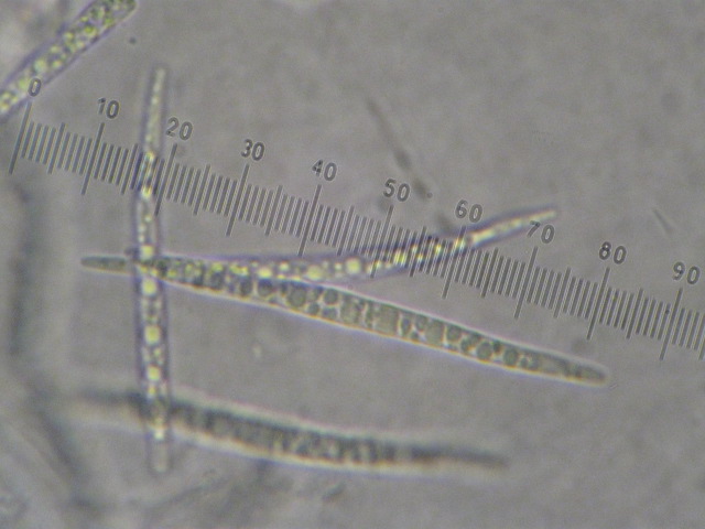 macrostoma