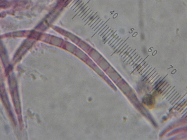 macrostoma