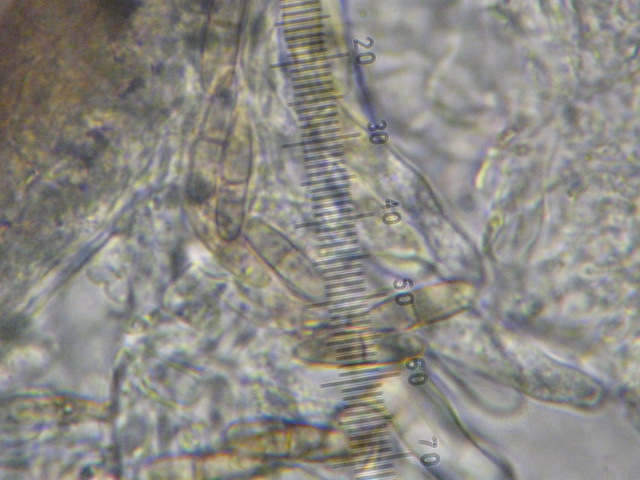 macrostoma