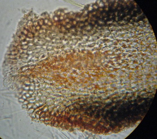 macrostoma