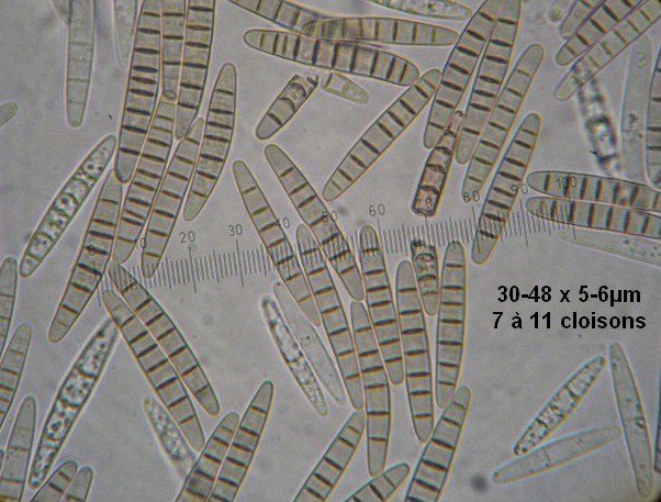 macrostoma
