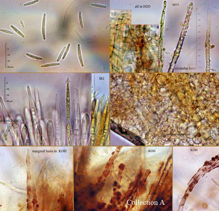 macrostoma