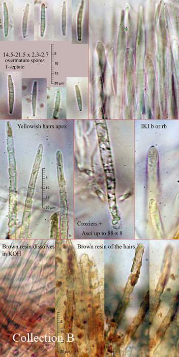 macrostoma