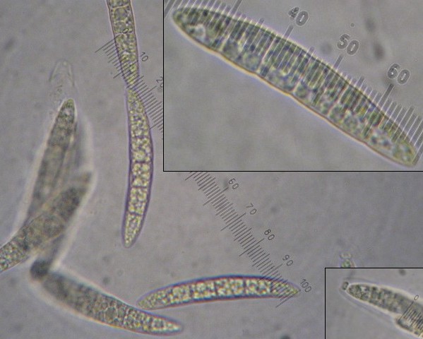 macrostoma