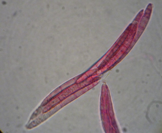 macrostoma