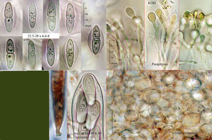 macrostoma