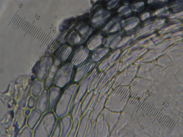 macrostoma
