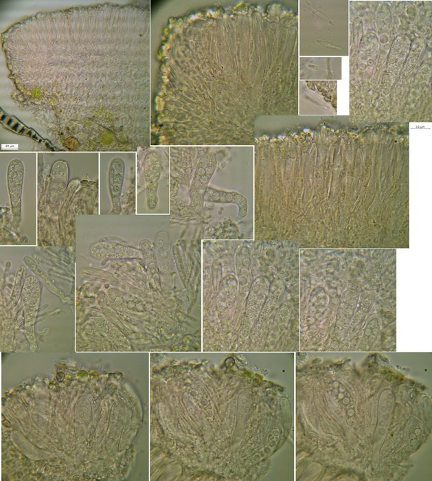 macrostoma