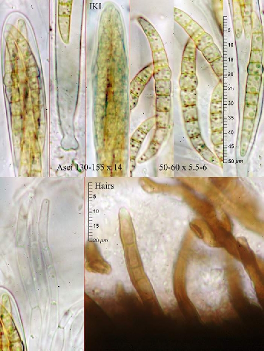 macrostoma