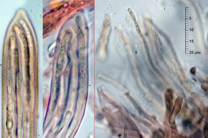 macrostoma