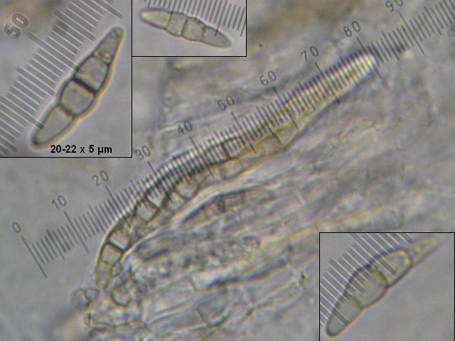 macrostoma