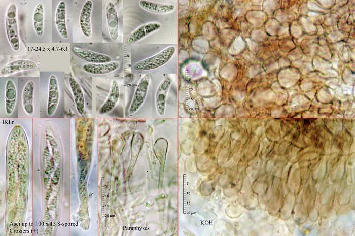 macrostoma