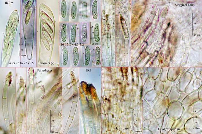 macrostoma