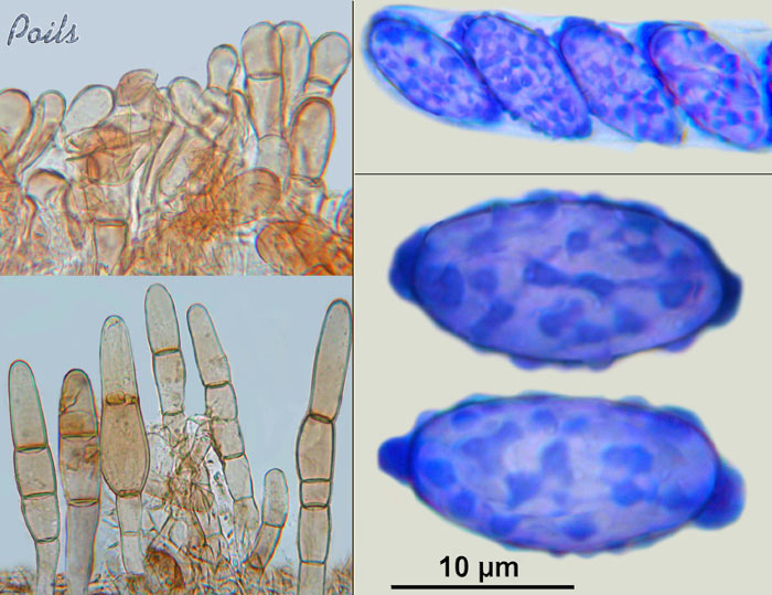 macrostoma