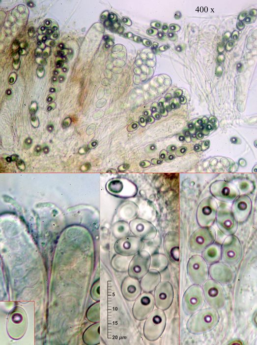 macrostoma