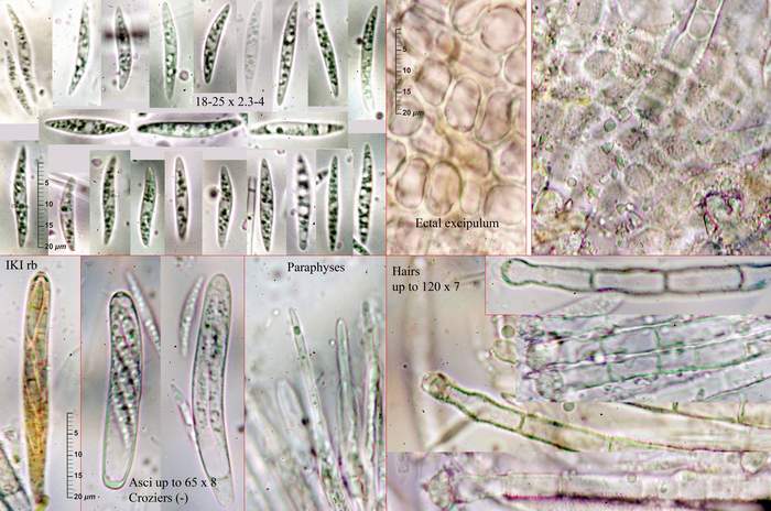 macrostoma