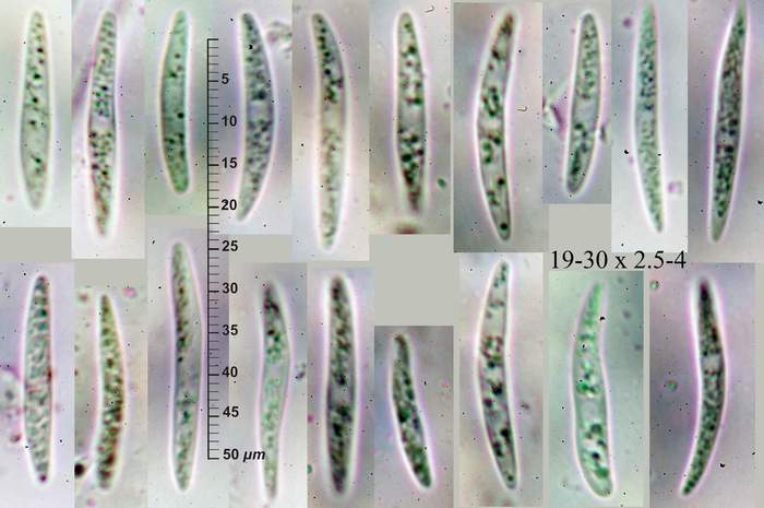macrostoma